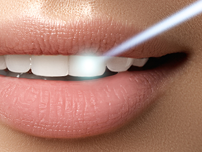 The image shows a close-up of a person's lips with a focus on a toothpaste or dental care product, indicated by the blue light and text.